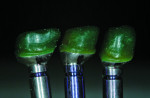 The wax-up for the PFM crowns performed on the CAD/CAM abutments.