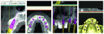 Figure 10 Maxillary implants to be placed in approved Upgrade Path.