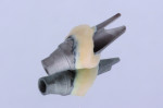 Figure 10 The second dentin firing. Technicians should fill in any voids or gaps with the second firing.