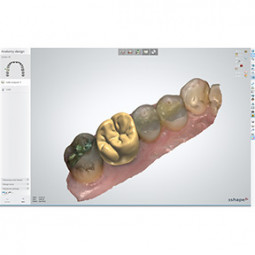 Dental System™ 2014 by 3Shape Inc.
