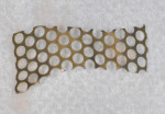 Figure 8 A 0.3-mm ti-mesh was customized for site No. 5 out of the mouth.