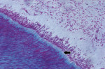 Figure 1 Coronal pulp. Fine connective tissue stroma with no inflammatory or degenerative changes, compatible with health, is evident. Note the predentin layer (arrow) indicating odontoblastic activity (Gomori’s trichrome, original at 10x magnification).