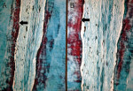 Figure 2 Radicular pulp. “A” shows pulp atrophy, characterized by reduction in pulp space due to reparative dentin formation (Gomori’s trichrome, original at 4x magnification); “B” shows a thick layer of secondary dentin  (Gomori’s trichrome, original at 10x magnification).
