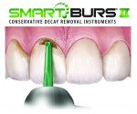 SS White Dental's SmartBurs® II