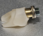 Figure 8 A Laser-Lok abutment
base is cemented extraorally to a zirconium abutment. The literature suggests
that connective tissue will functionally orient to the lased surface and may contribute
to enhanced clinical outcomes by creating a supracrestal tissue barrier to microbial
challenges.