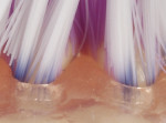 Figure 3. Brush head comprising extremely tapered bristles due to narrow diameter and increased flexibility.