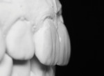 Figure 17. Right lateral view of the porcelain on the working model.