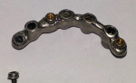 Figure 1. The patient’s restoration demonstrated poor fit and
excessive attachment wear
related to the loosening of the
welded attachments.