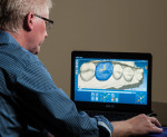 Figure 3. Culp designing an upper first molar with the Planmeca software.