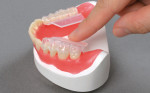 Q3 Pack sets up to 4 posterior teeth at once.