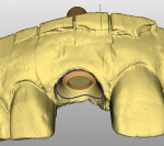 Figure 14. CAD of a Straumann Cares abutment with Cerec 3D software.