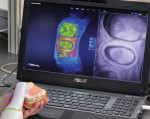 Figure 1. Utilizing the Planscan wand, a conventional model quickly and accurately converts into a 3D image ready for design.