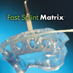 L | Fast Splint Matrix