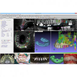 GuideMia by GuideMia Digital Dentistry