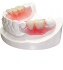 Bayflex™ Partials by Bayshore Dental Studio