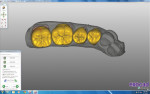 Figure 3 Design of the monolithic crowns in Exocad software.
