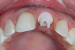 Figure 19   Occlusal view showing the redeveloped gingival profiles recouping the tissue loss.