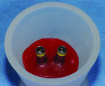 Figure 8 Place implant replicas into small flexible mixing cup with GC pattern resin prior to or at the beginning of the restorative appointment.