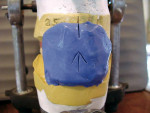 Figure 4a  Dentate matrix fabrication.