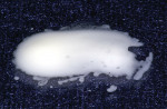 Figure 2  Embrace WetBond sealant demonstrates its hydrophilic nature by being miscible with water. Note a mixing of the water with the sealant. This mixing activates the Embrace WetBond’s acidity and affinity to the etched enamel surface.