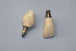 Figure 5 Laboratory-fabricated provisional implant restorations No. 7 and No. 10. Customizable polymer abutments with a titanium base for Straumann’s Bone Level Narrow CrossFit® implants (Straumann, www. straumann.us) were used. Provisional crowns were made from heat-cured acrylic. Note the emergence contours of the transmucosal portion of the customized abutments and the scalloped finishing line for the cementable provisional crowns.