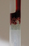 Figure 5 Porosity of the intergranular space
demonstrated by blood uptake.