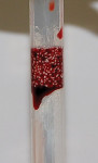 Figure 6 Porosity of the intergranular space
demonstrated by blood uptake.