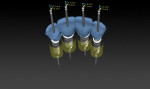 Figure 11 Alignment of the implants to exit through the palatal surface of the diagnostic wax-up for screw access.