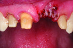 Figure 12 Teeth prepared following extraction.
