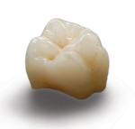 NexxZr T Shaded 19 Dental Zirconia