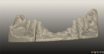 Fig 4. The scan of the model stone captured all the intricate details.