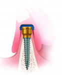 C | LOCATOR™ Overdenture Implant System (LODI)