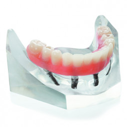 RevitaliZe Model by Zimmer Biomet Dental