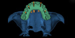 Figure 15 Virtual maxillary treatment plan (occlusal view).