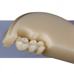 KATANA™ Zirconia ML Discs by Zahn Dental