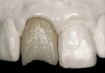 Figure 9  The fired base dentin.