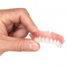 Full Dentures by ThermoDent Inc.