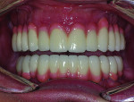 Post-treatment view showing complete oral reconstruction.