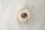 Access achieved through the occlusal surface of the implant-retained crown.