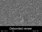 Figure 17  SEM micrograph of the debonded veneer on tooth No. 7. Note no evidence of etching.