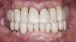 Figure 2 Pretreatment intraoral frontal view.