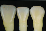 Fig 7. Natural anterior teeth.