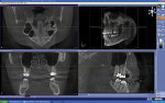 Figure 2  Galileos® CBCT scan data examples (Sirona Dental Systems).