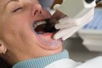 Figure 6  CEREC® (Sirona Dental Systems)image acquisition in the mouth.