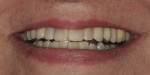 Fig 1. Pre-treatment clinical photograph of the patient's smile.