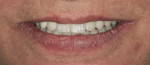 Fig 7. Post-treatment photograph showing final smile.