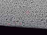 Fig 10.Electron microscopy of a histologic section of EP No. 3. The enamel structure is normal, exhibiting prisms (coursing from upper right to lower left) and daily cross striations (appearing as dark lines that cross the diameters of prisms [see arrows]). Note also the aprismatic enamel (AE) containing daily incremental lines (arrows). Field width = 100 μm.