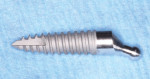 Fig 3. The treatment plan called for placement of six 2.9-mm-diameter, 10-mm-long SATURNO implants with a 4-mm cuff height.