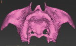 Fig 4. Occlusal view of the 3D model created from the CT scan data.