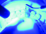Using PREAT's eFiber to reinforce dentures.